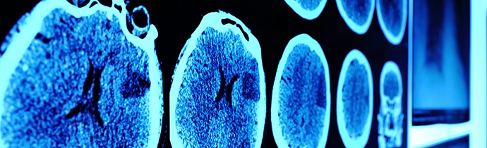 brain-scan-images.jpg